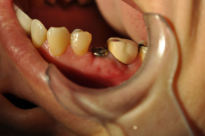 %_tempFileNameImplant%20113c9%