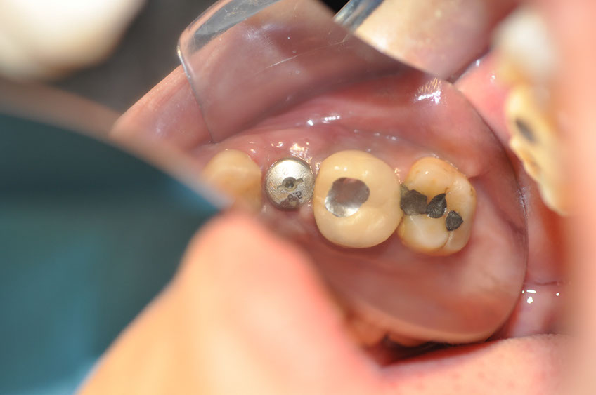 %_tempFileNameImplant%20113c91%