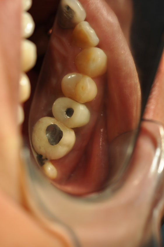 %_tempFileNameImplant%20113d4%