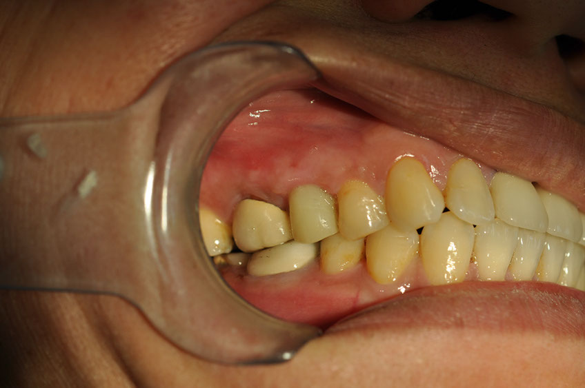 %_tempFileNameImplant%20113d5%