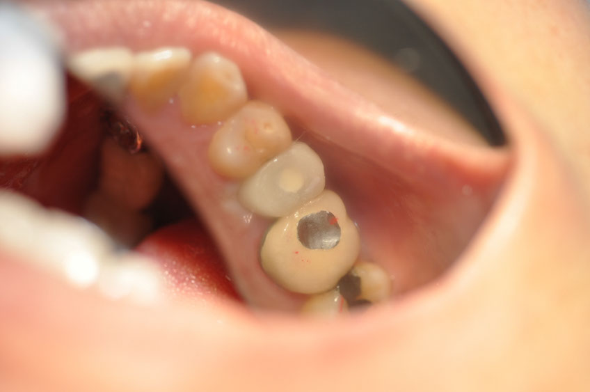 %_tempFileNameImplant%20113d6%