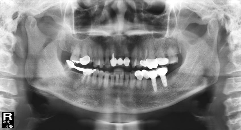 %_tempFileNameImplant%20113e1%