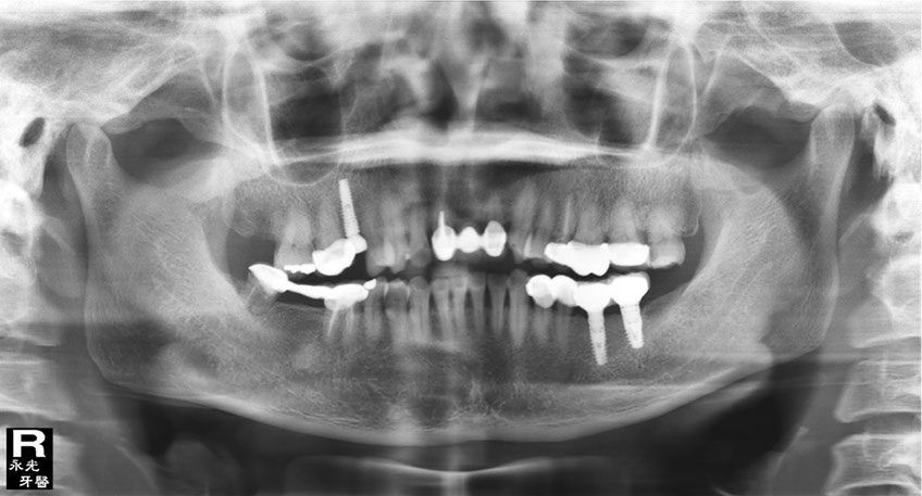 %_tempFileNameImplant%20113e3%