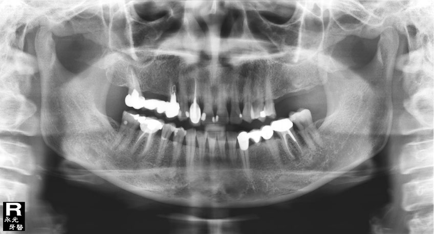 %_tempFileNameImplant%20115Ea2%