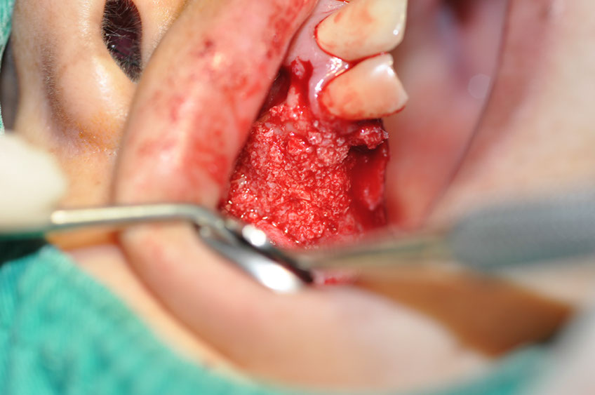 %_tempFileNameImplant%20115Eb5%