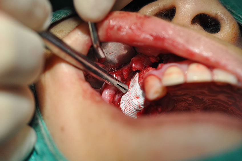 %_tempFileNameImplant%20115Eb8%