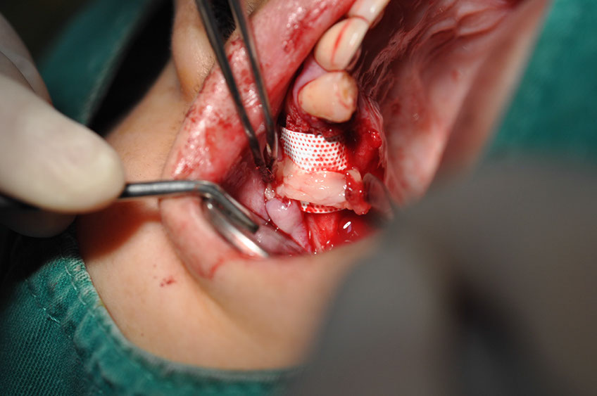 %_tempFileNameImplant%20115Ec1%
