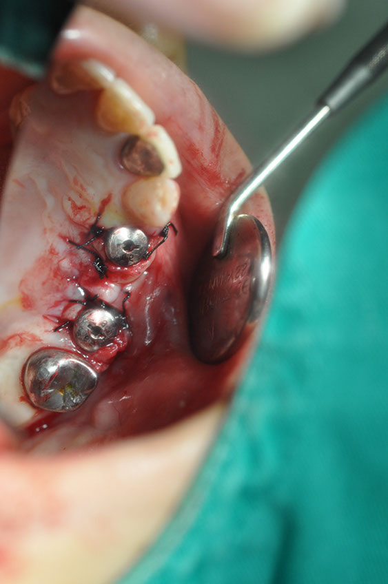 %_tempFileNameImplant%20115Ec7%