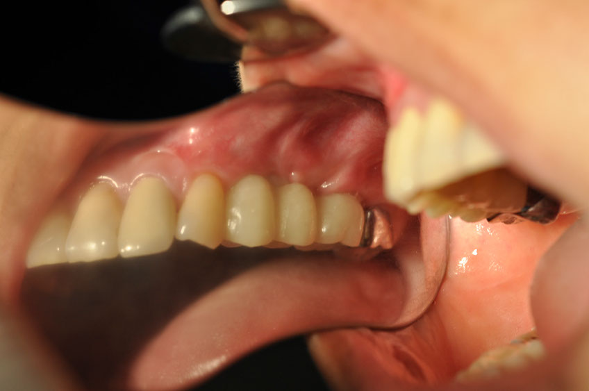 %_tempFileNameImplant%20115Ed2%