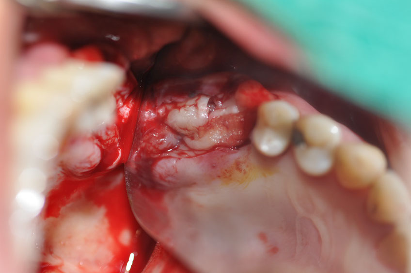 %_tempFileNameImplant%20115a9%