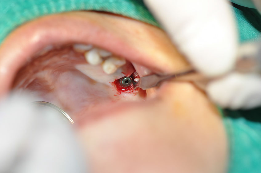 %_tempFileNameImplant%20115b3%