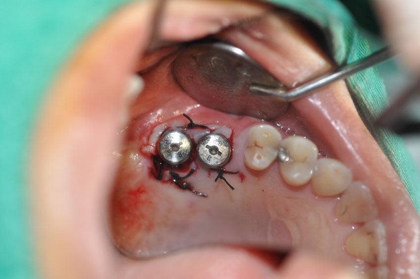 %_tempFileNameImplant%20115b4%