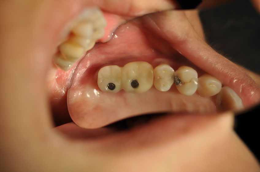 %_tempFileNameImplant%20115c1%