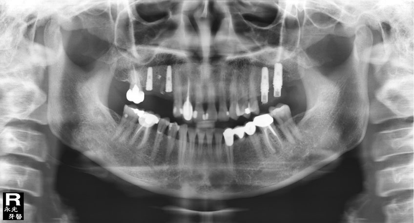 %_tempFileNameImplant%20115d2%