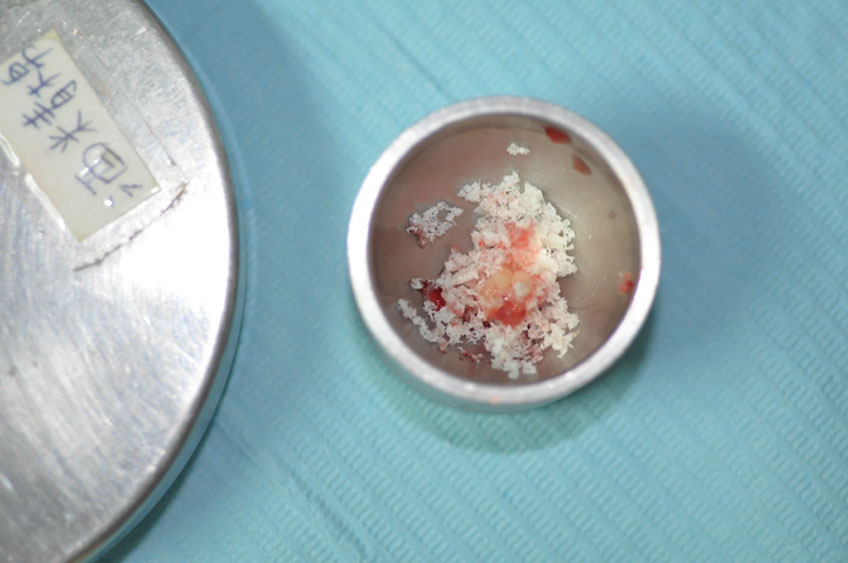 %_tempFileNameImplant%20116a6%