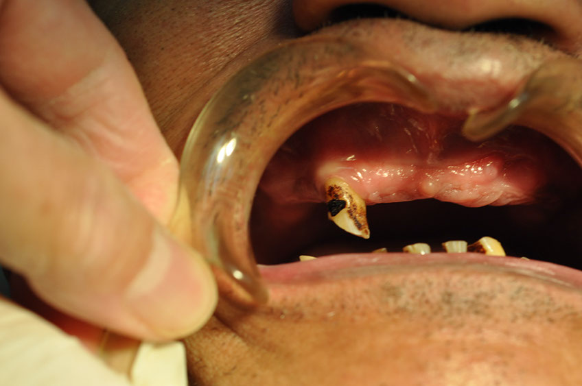 %_tempFileNameImplant%20118a1%