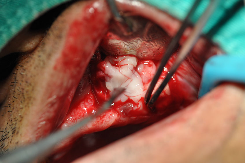 %_tempFileNameImplant%20118b1%
