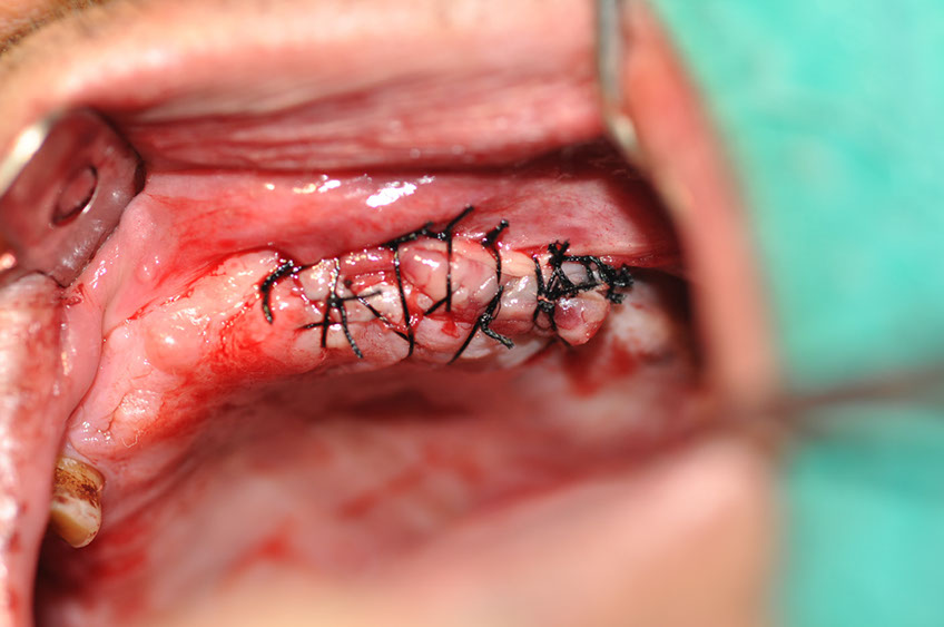 %_tempFileNameImplant%20118b2%
