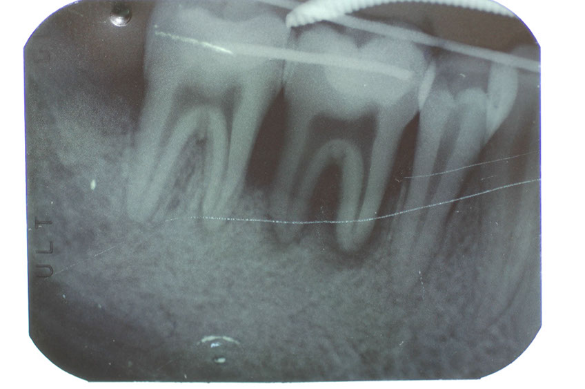 %_tempFileNameImplant%2011b4%