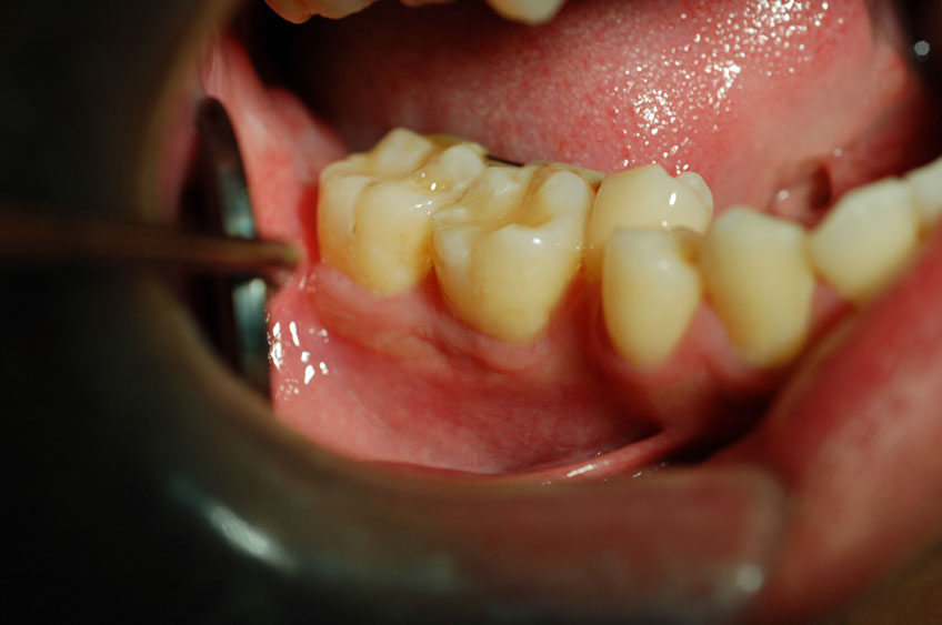 %_tempFileNameImplant%2011c8%