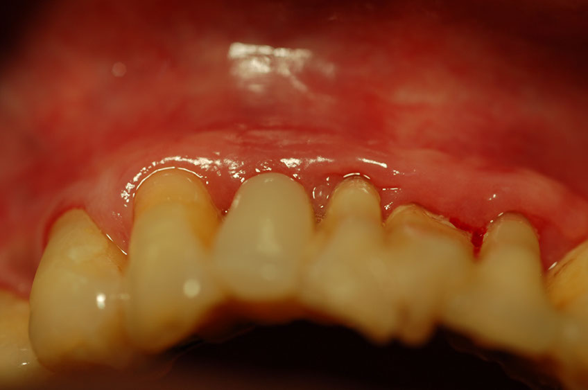 %_tempFileNameImplant%2012g3%