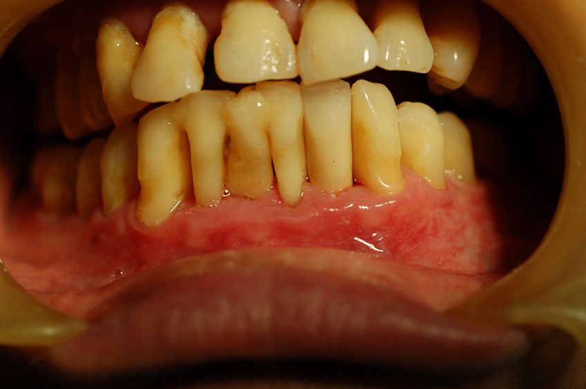 %_tempFileNameImplant%2012g4%