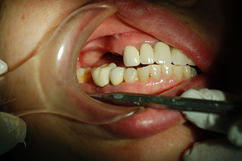 %_tempFileNameImplant%2015a2-1%