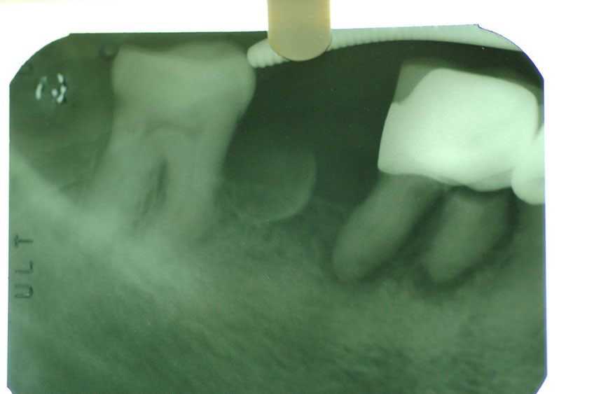 %_tempFileNameImplant%2015a2-3%