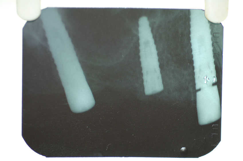 %_tempFileNameImplant%2015a2-4%