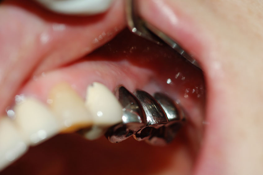 %_tempFileNameImplant%2015a5%