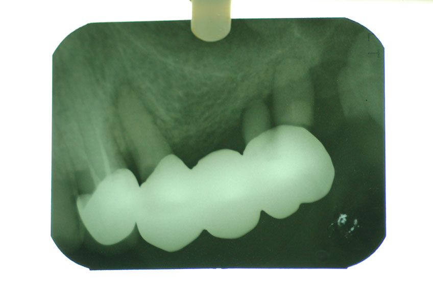 %_tempFileNameImplant%2015a6%