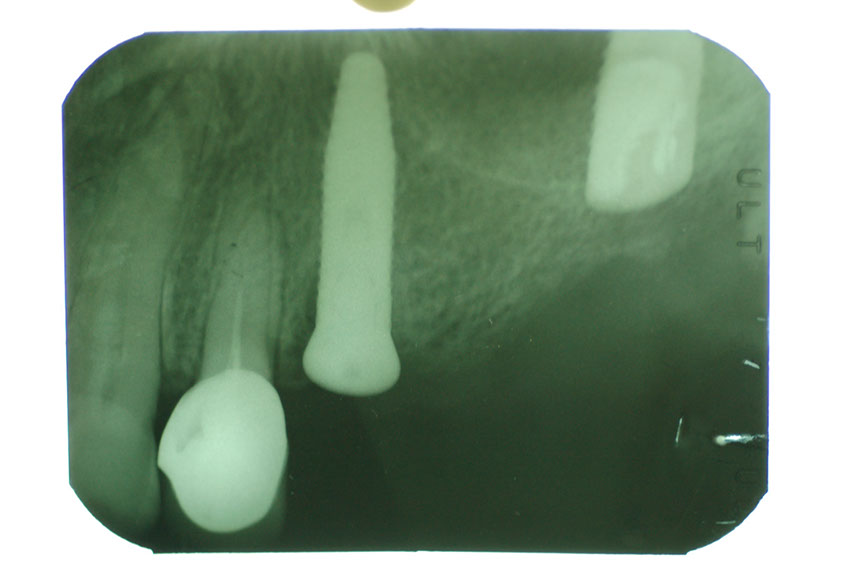%_tempFileNameImplant%2015a7%