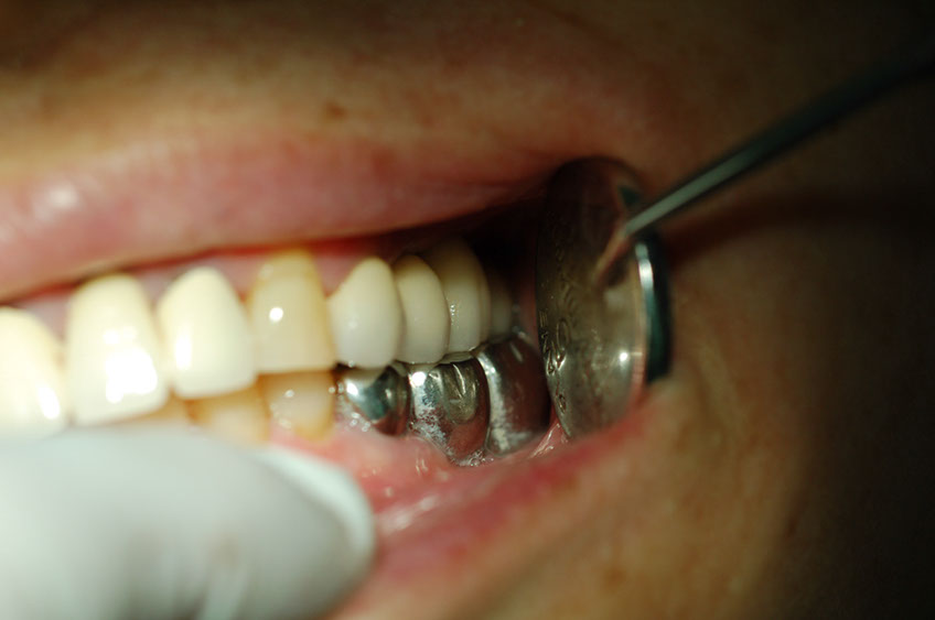 %_tempFileNameImplant%2015c3%