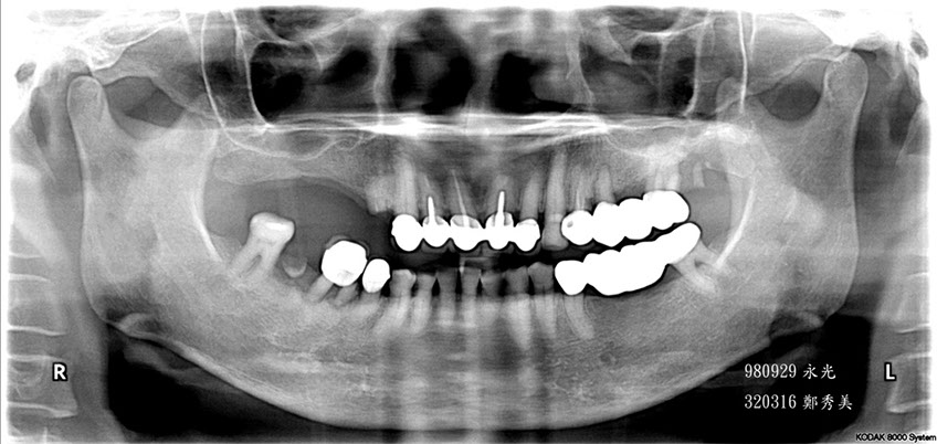 %_tempFileNameImplant%2015d1%