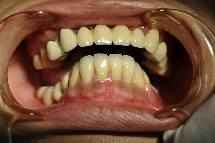 %_tempFileNameImplant%2017c2%
