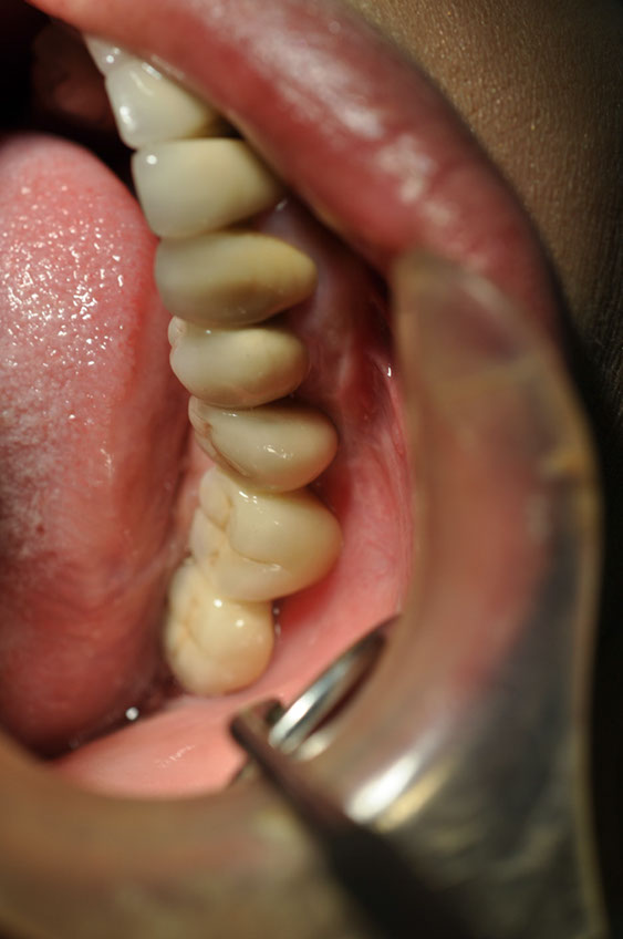 %_tempFileNameImplant%2017c3%