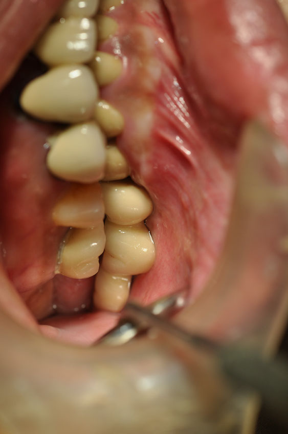 %_tempFileNameImplant%2017c4%