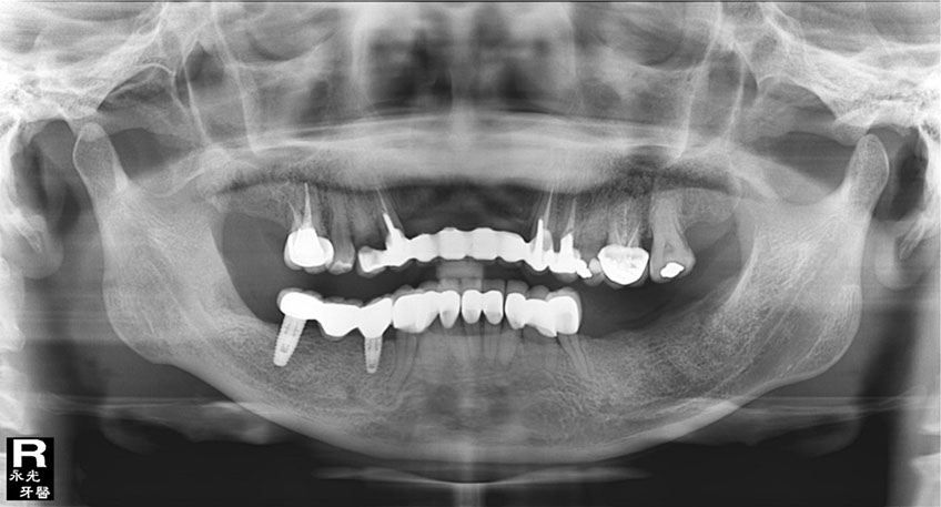 %_tempFileNameImplant%2017d2%