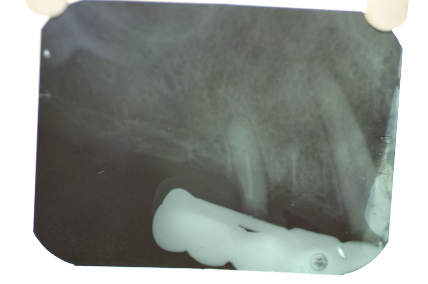 %_tempFileNameImplant%2018b%
