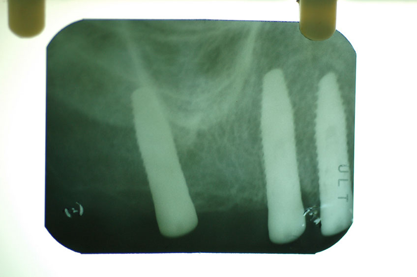 %_tempFileNameImplant%2018c%