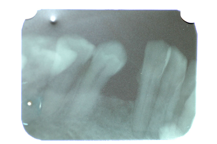 %_tempFileNameImplant%201a%
