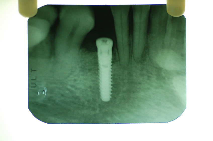 %_tempFileNameImplant%201b2%
