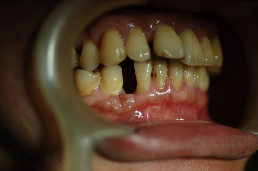 %_tempFileNameImplant%201e%