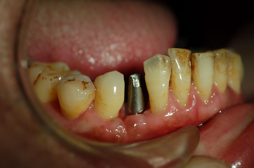 %_tempFileNameImplant%201g%