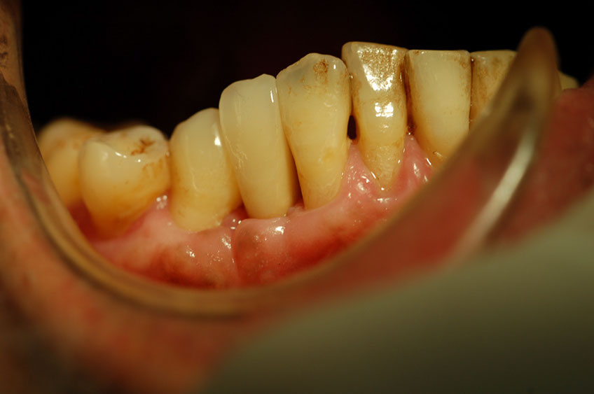 %_tempFileNameImplant%201h2%