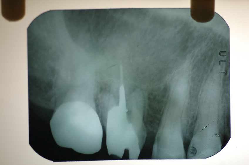 %_tempFileNameImplant%2023a1%