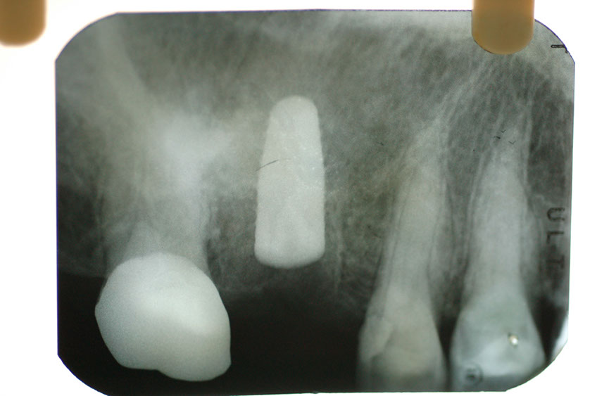 %_tempFileNameImplant%2023a2%