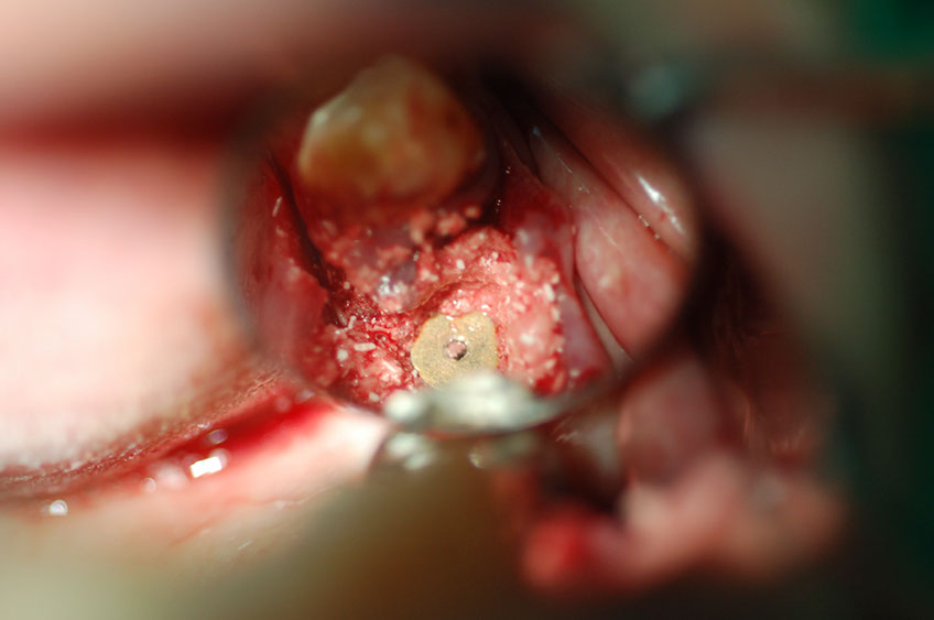 %_tempFileNameImplant%2023b2%