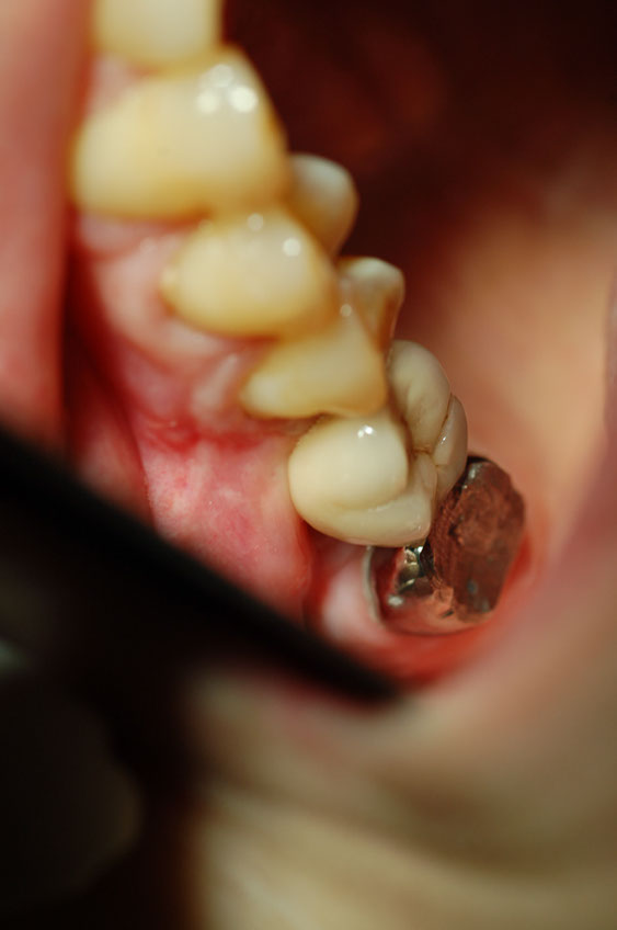 %_tempFileNameImplant%2023c2%