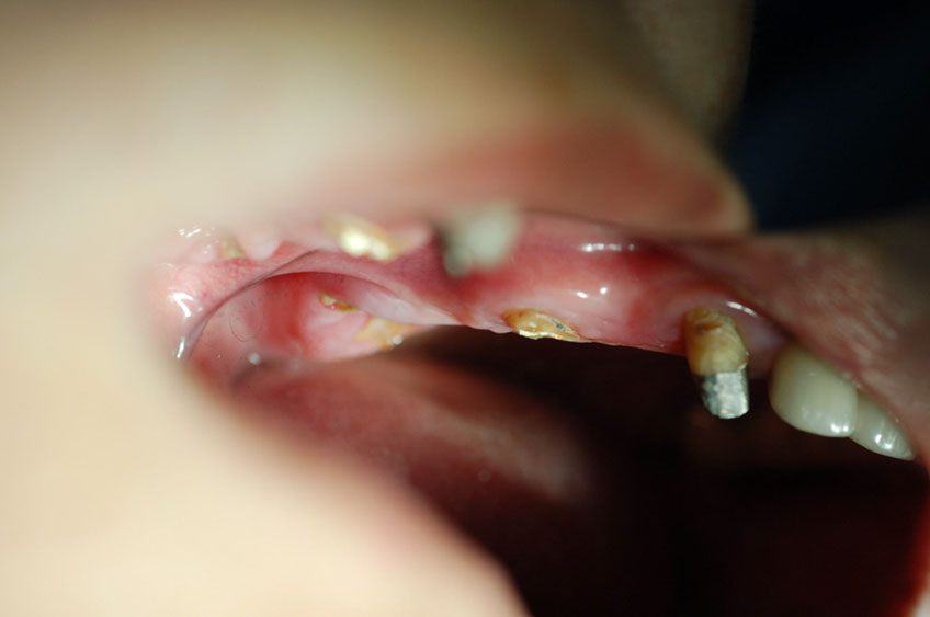 %_tempFileNameImplant%2024a0%